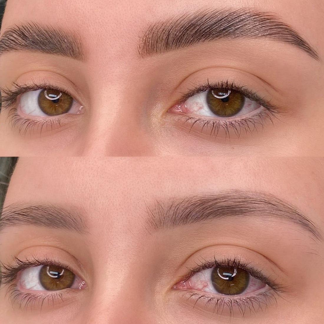 Brow Lift à Genève: Comment restructurer et sublimer naturellement les sourcils