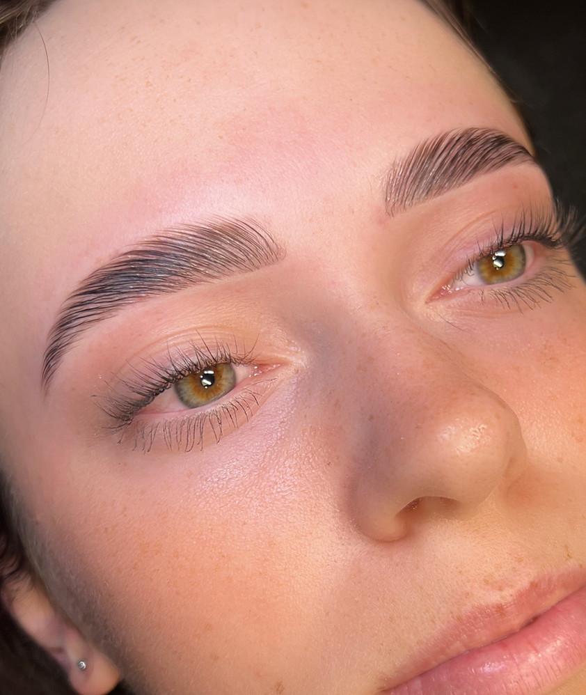 Brow Lift à Genève: Comment restructurer et sublimer naturellement les sourcils